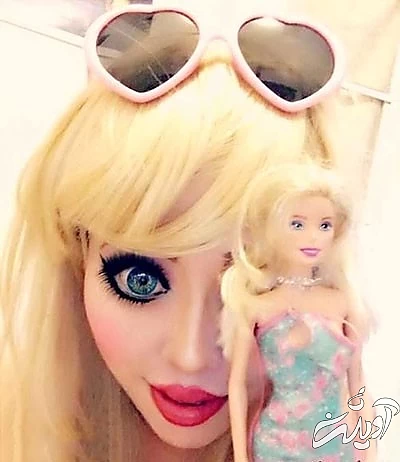 عجیبترین و مضحکترین جراحیهای زیبایی